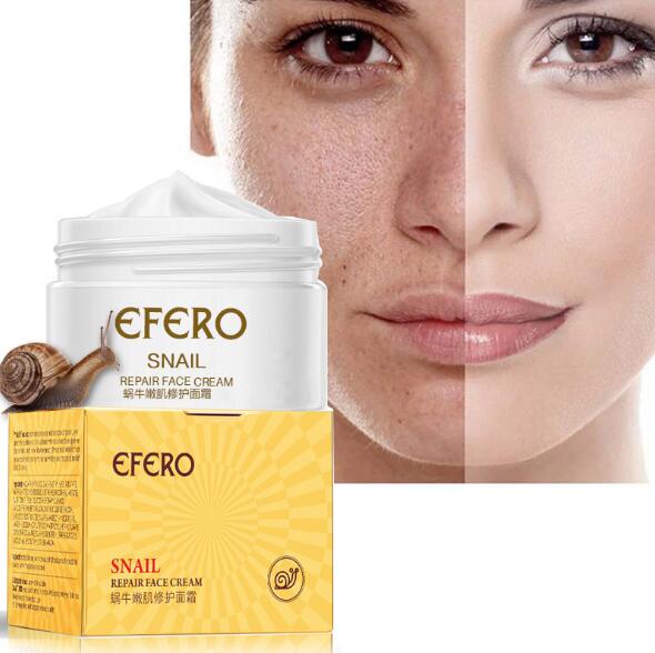 Anti Aging Snail Essence Face Cream Whitening - shopngos