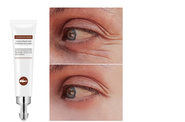 Crocodile Wrinkles Eye Cream Hyaluronic Acid Gel - shopngos