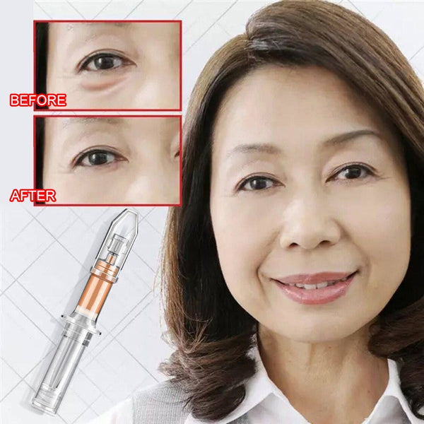 anti-aging in 2 Minutes Instant Lifting Eye Cream Anti Puffiness - shopngos